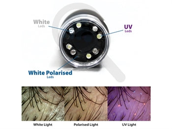 DERMATOSCOPIO A LED POLARIZZATI+UV+BIANCHI MIC Wi-Fi & USB con software