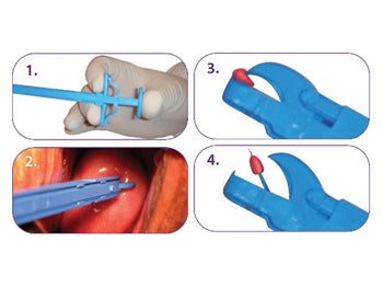 PINZA BIOPSIA GYN&PUSH 21,5 cm - sterile-conf. 25 pezzi